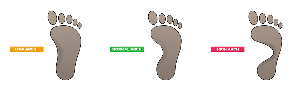 Foot Arch Types